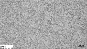 人B淋巴白血病细胞 NALM-6