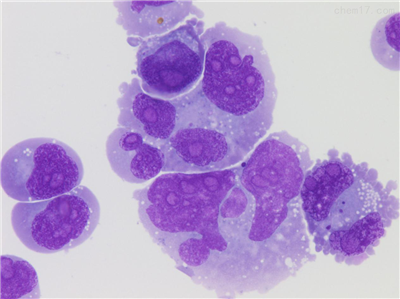 colo320人结直肠腺癌细胞   COLO320